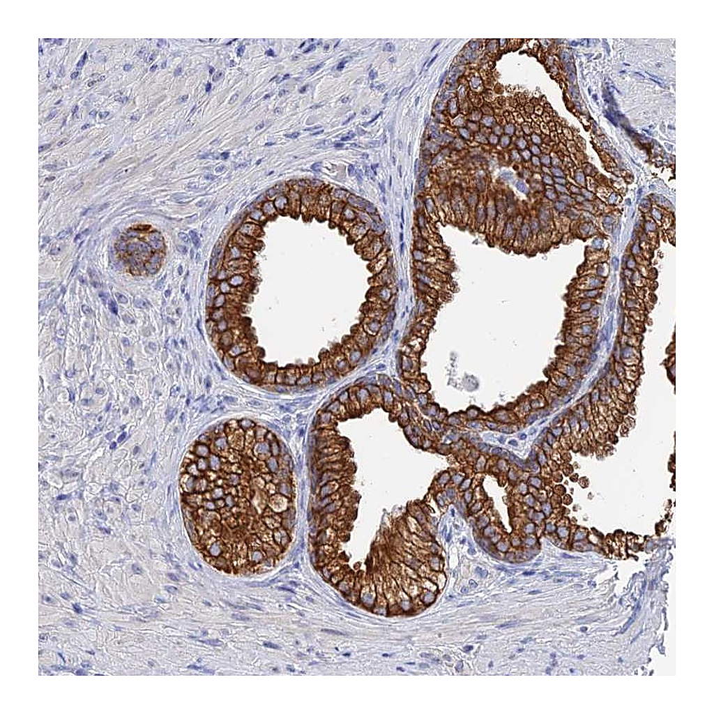 Atlas Antibodies Anti-SRFBP1 Antibody