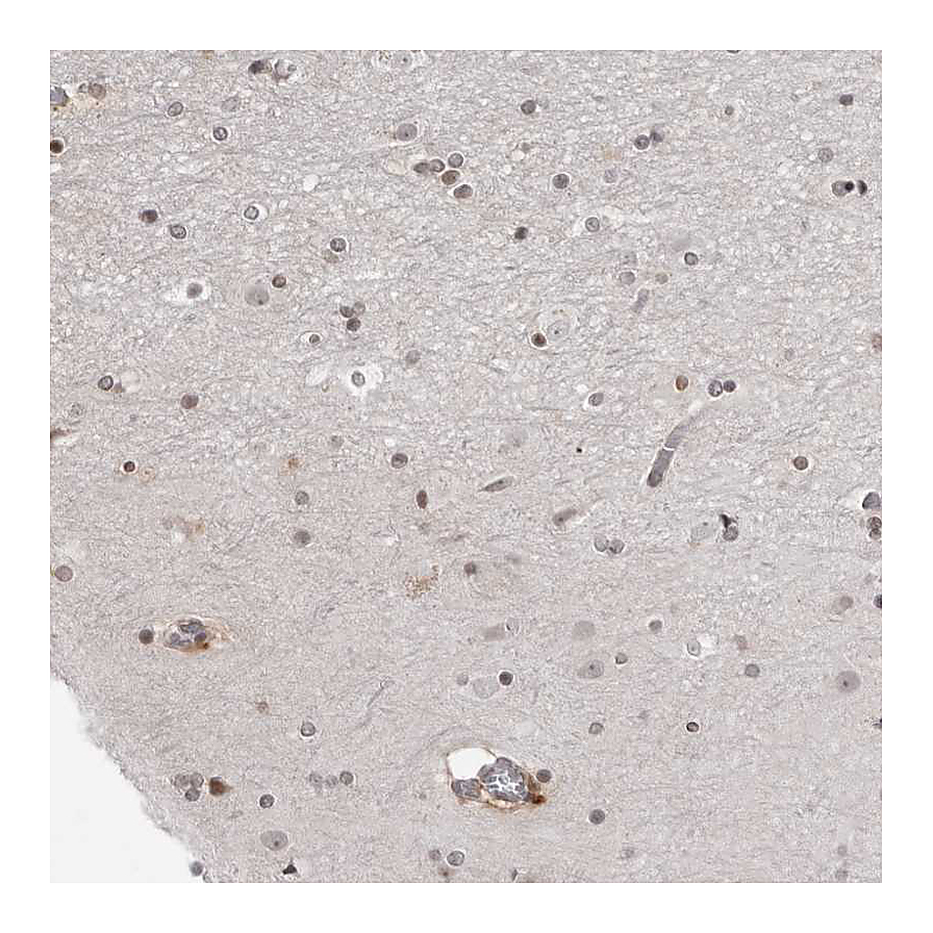 Atlas Antibodies Anti-SRGAP2 Antibody