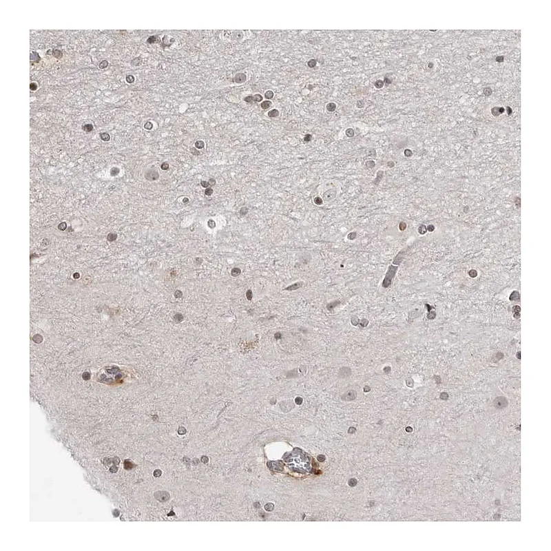 Atlas Antibodies Anti-SRGAP2 Antibody