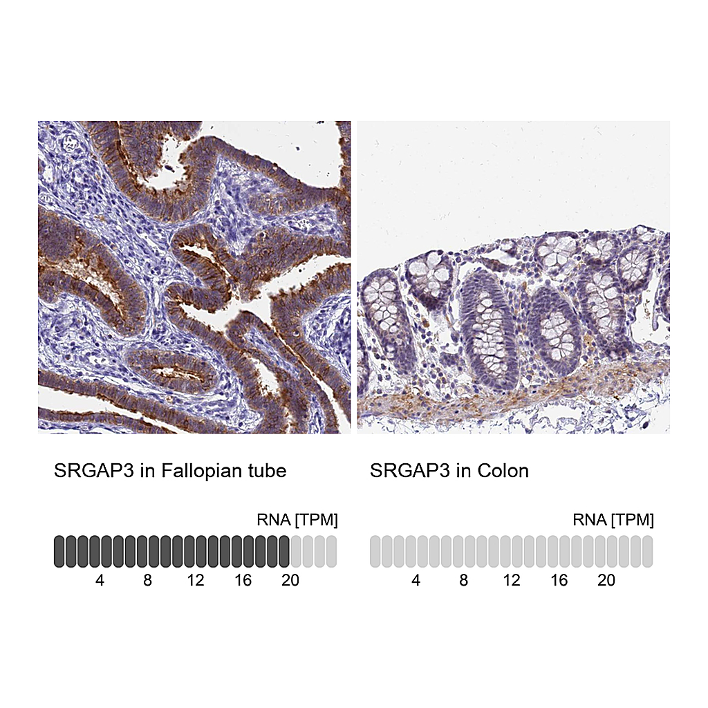 Atlas Antibodies Anti-SRGAP3 Antibody