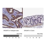 Atlas Antibodies Anti-SRGAP3 Antibody