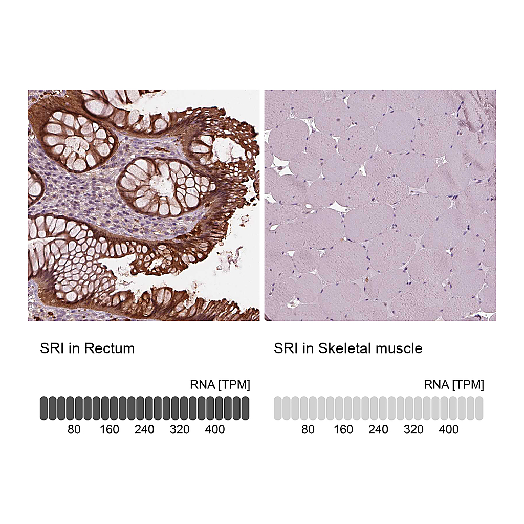 Atlas Antibodies Anti-SRI Antibody