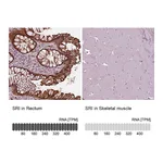 Atlas Antibodies Anti-SRI Antibody