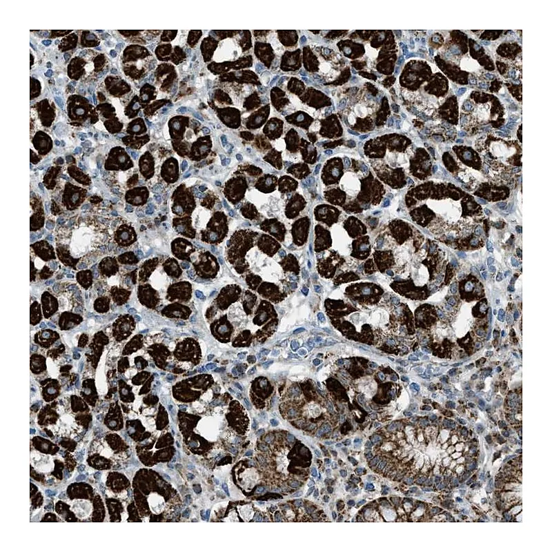 Atlas Antibodies Anti-SRM Antibody