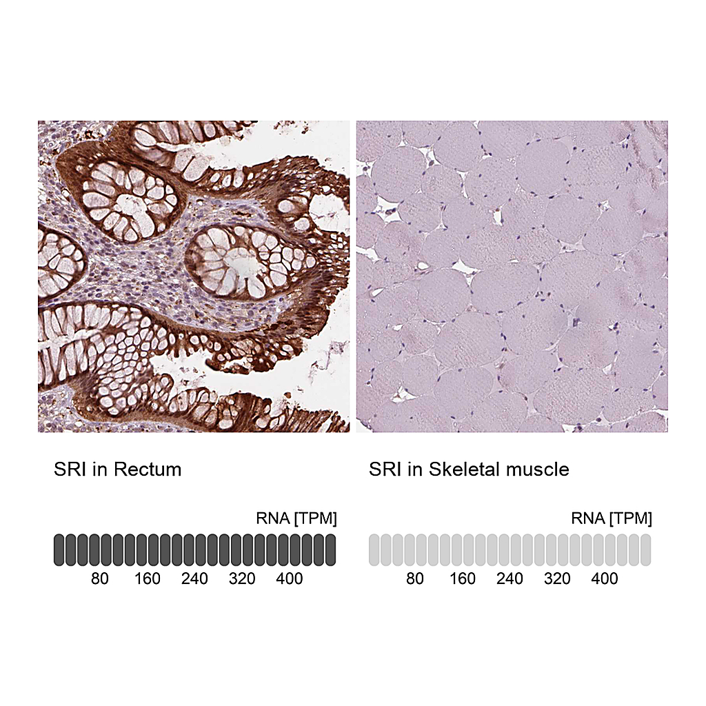 Atlas Antibodies Anti-SRI Antibody