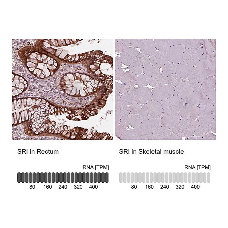 Atlas Antibodies Anti-SRI Antibody
