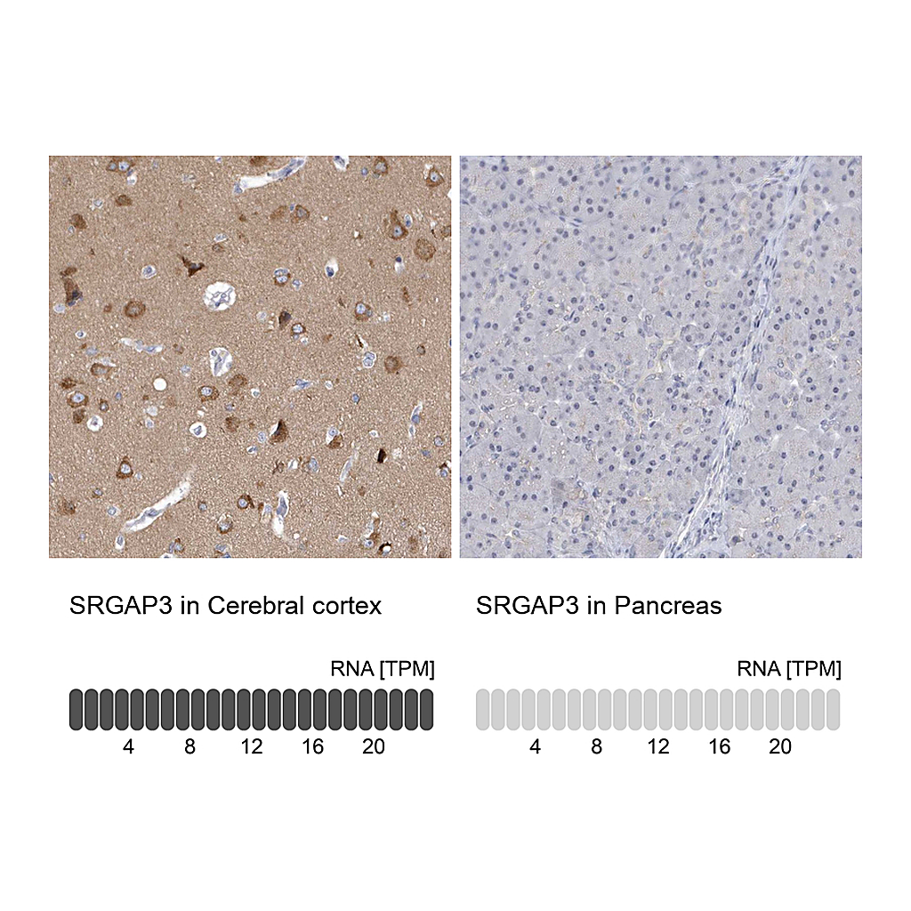 Atlas Antibodies Anti-SRGAP3 Antibody