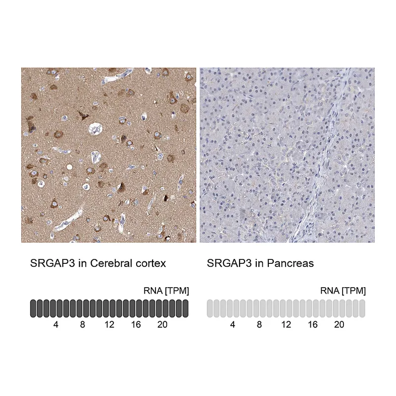 Atlas Antibodies Anti-SRGAP3 Antibody