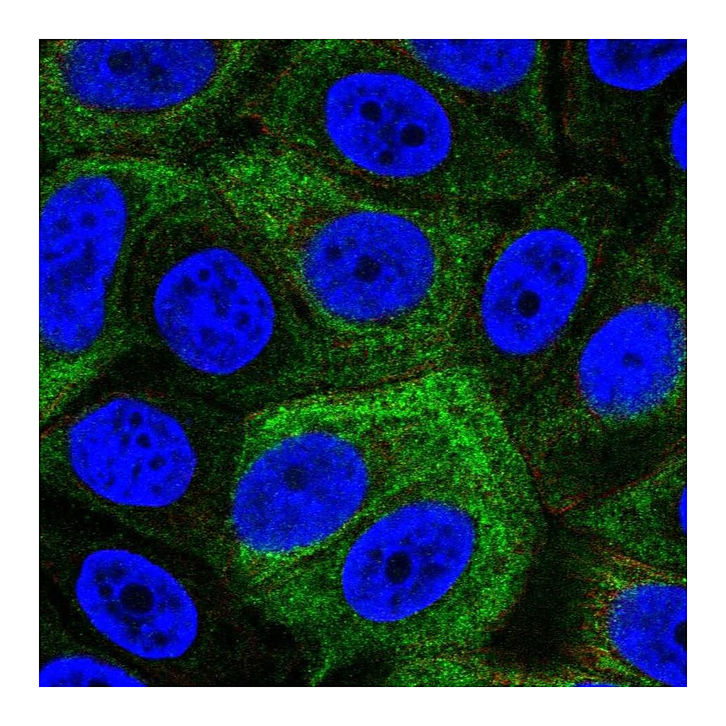 Atlas Antibodies Anti-SRMS Antibody