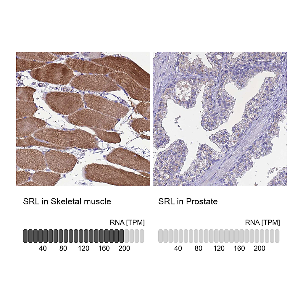 Atlas Antibodies Anti-SRL Antibody