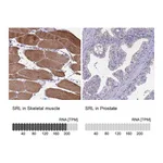 Atlas Antibodies Anti-SRL Antibody