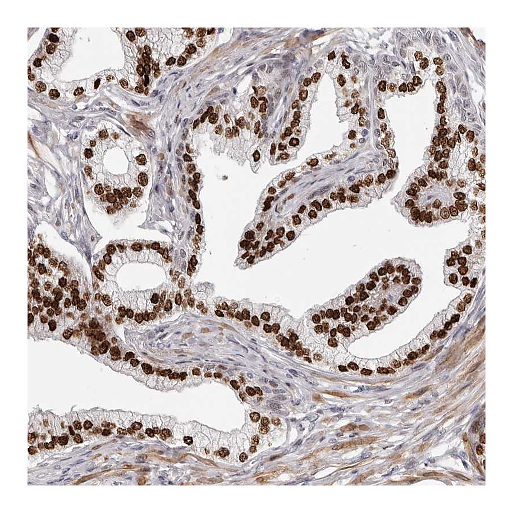 Atlas Antibodies Anti-SRP19 Antibody