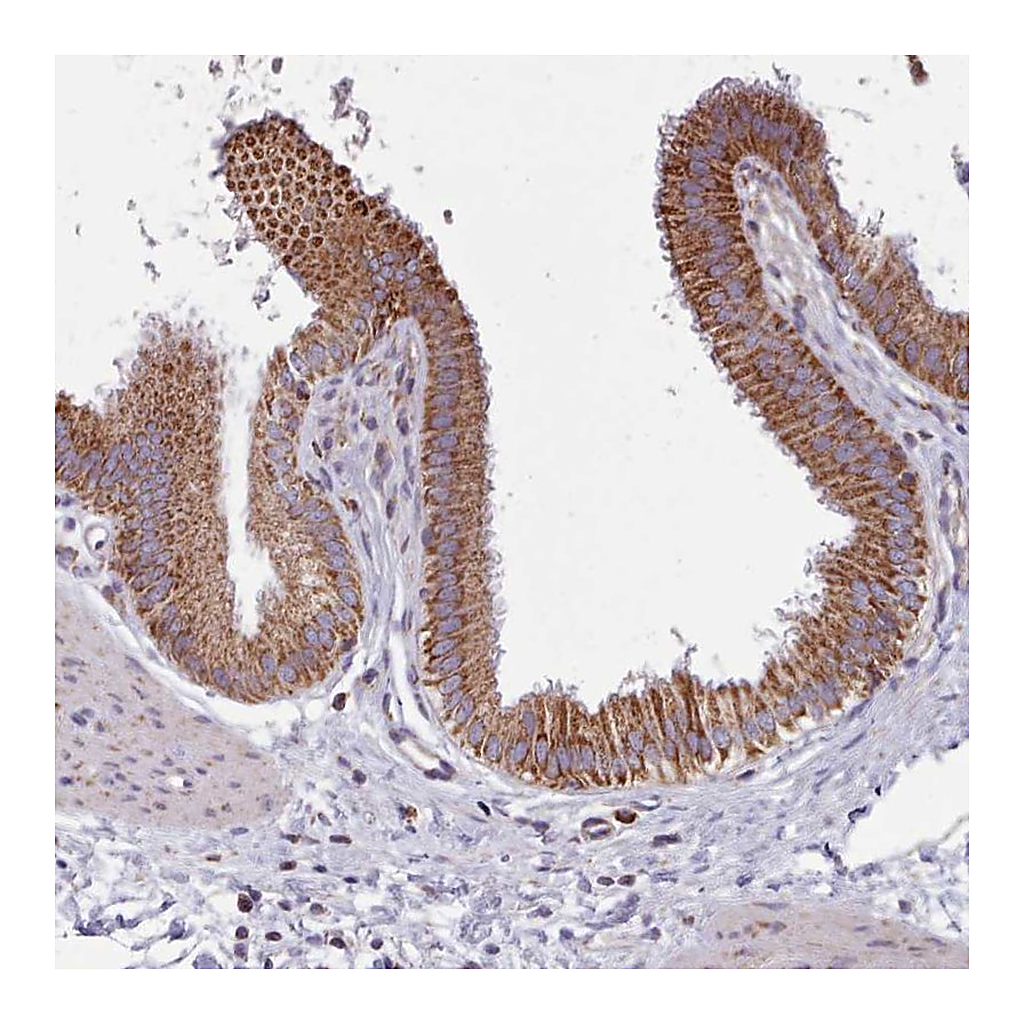 Atlas Antibodies Anti-SRP54 Antibody