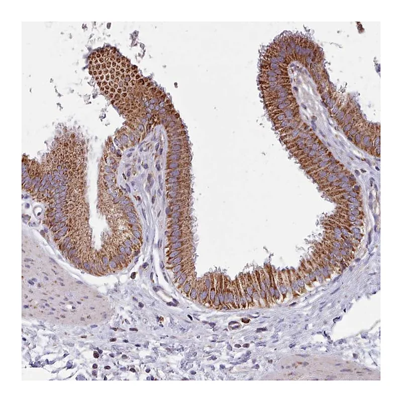Atlas Antibodies Anti-SRP54 Antibody