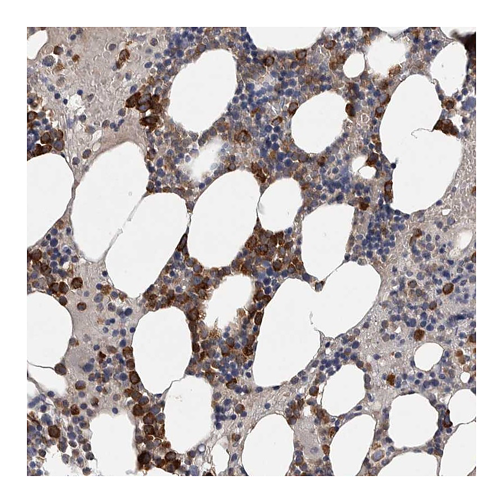 Atlas Antibodies Anti-SRP68 Antibody