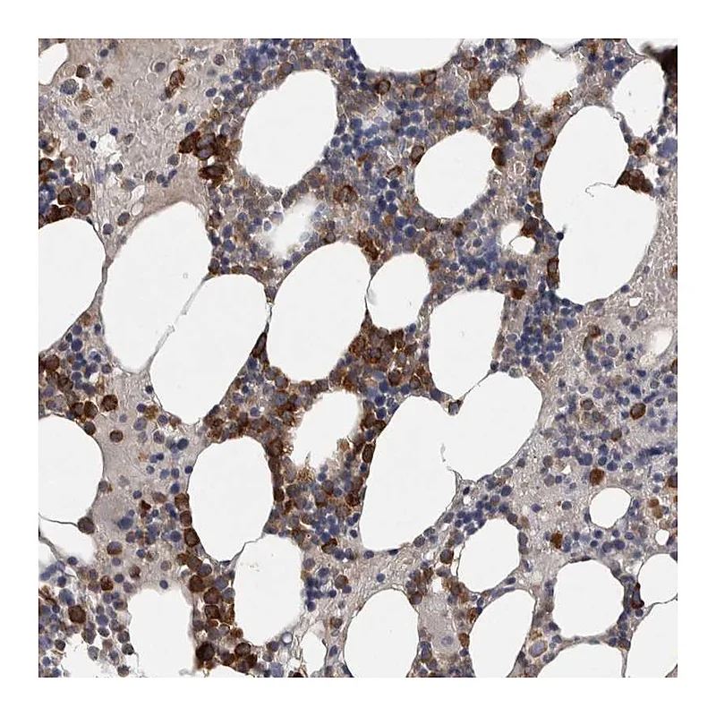 Atlas Antibodies Anti-SRP68 Antibody
