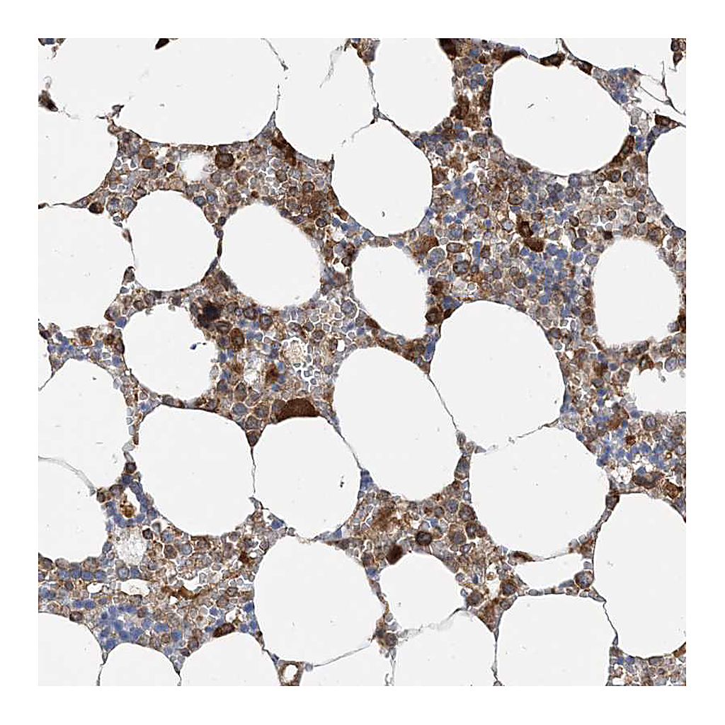 Atlas Antibodies Anti-SRP72 Antibody