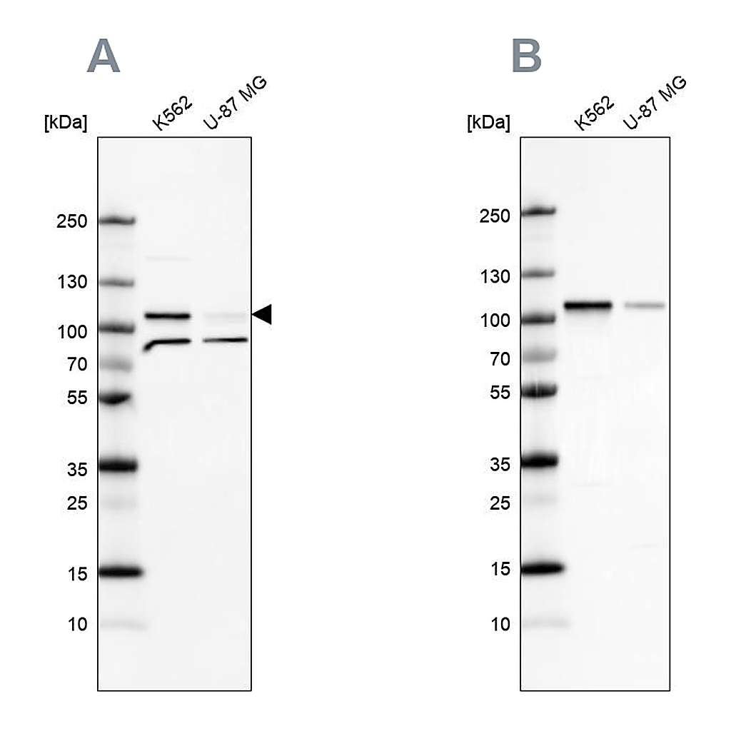 Atlas Antibodies Anti-SRPK1 Antibody