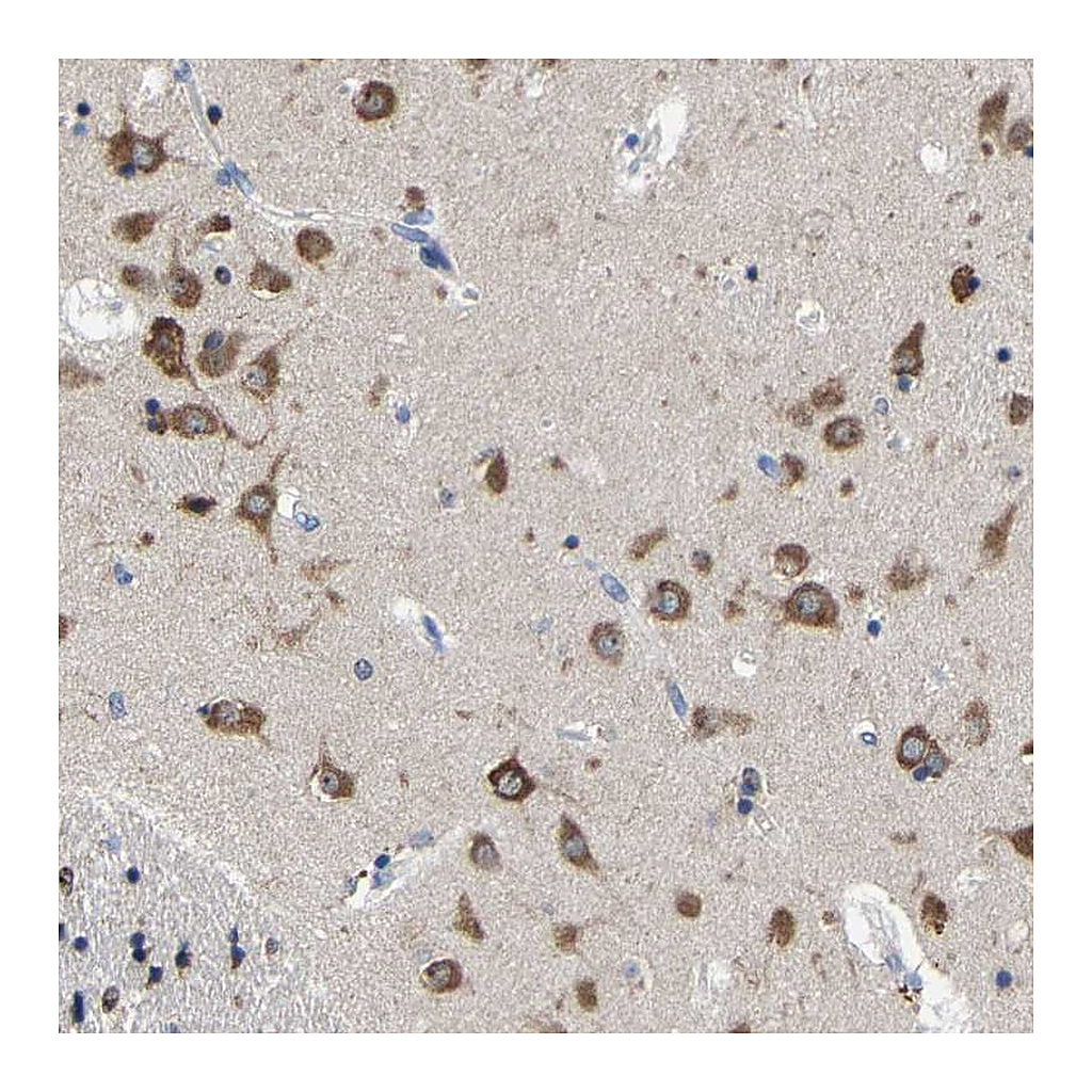 Atlas Antibodies Anti-SRPK2 Antibody