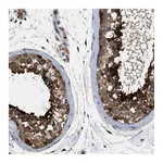 Atlas Antibodies Anti-SRPK1 Antibody