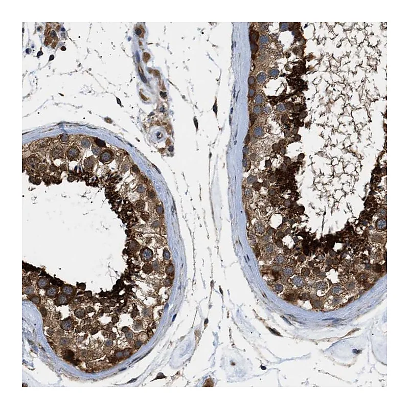 Atlas Antibodies Anti-SRPK1 Antibody