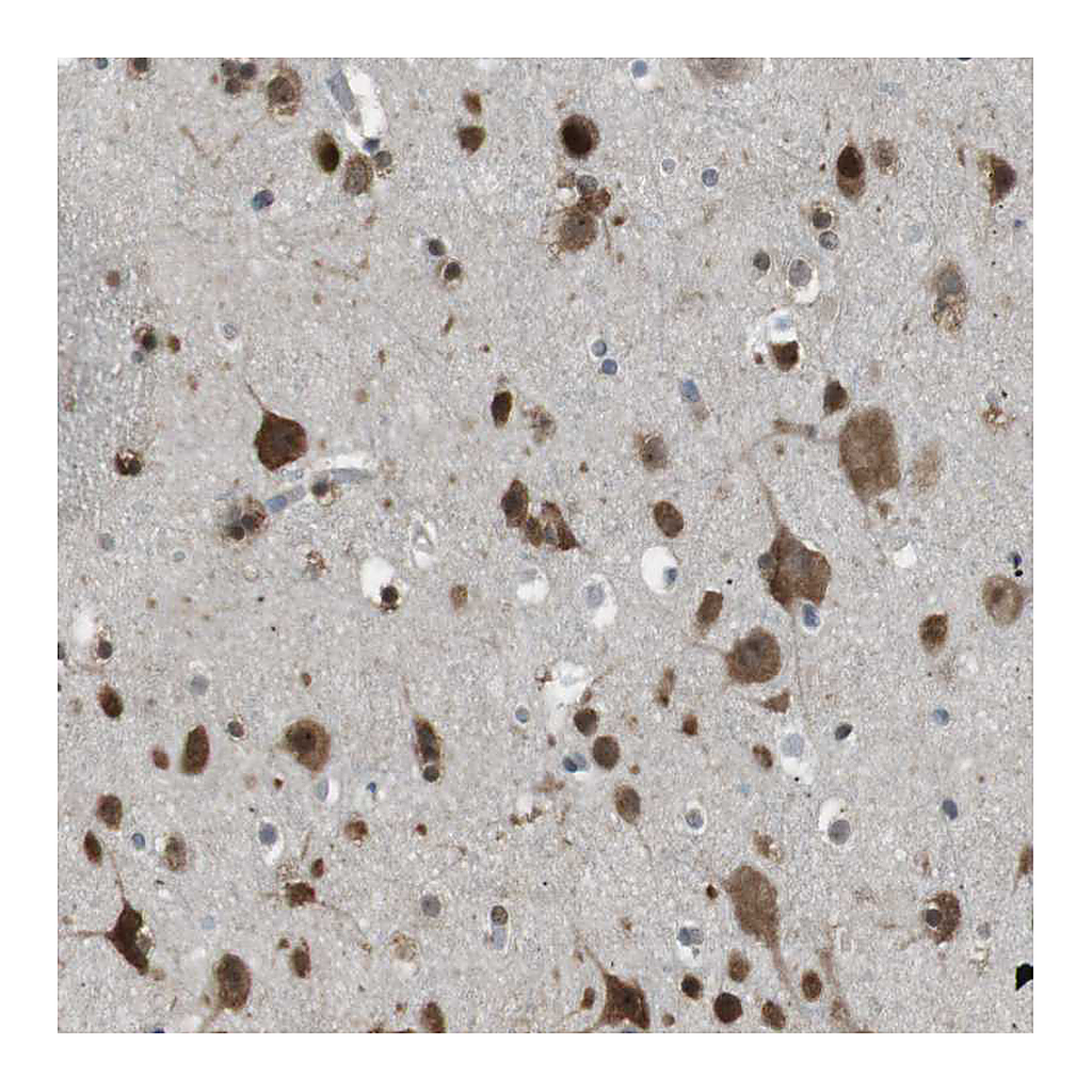 Atlas Antibodies Anti-SRPK2 Antibody