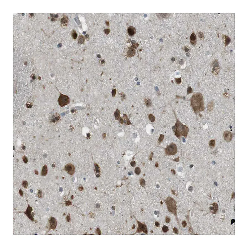 Atlas Antibodies Anti-SRPK2 Antibody