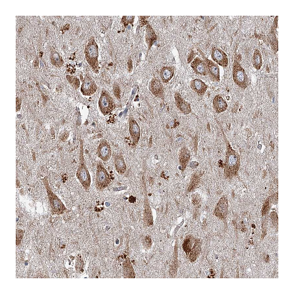 Atlas Antibodies Anti-SRPX2 Antibody