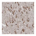 Atlas Antibodies Anti-SRPX2 Antibody