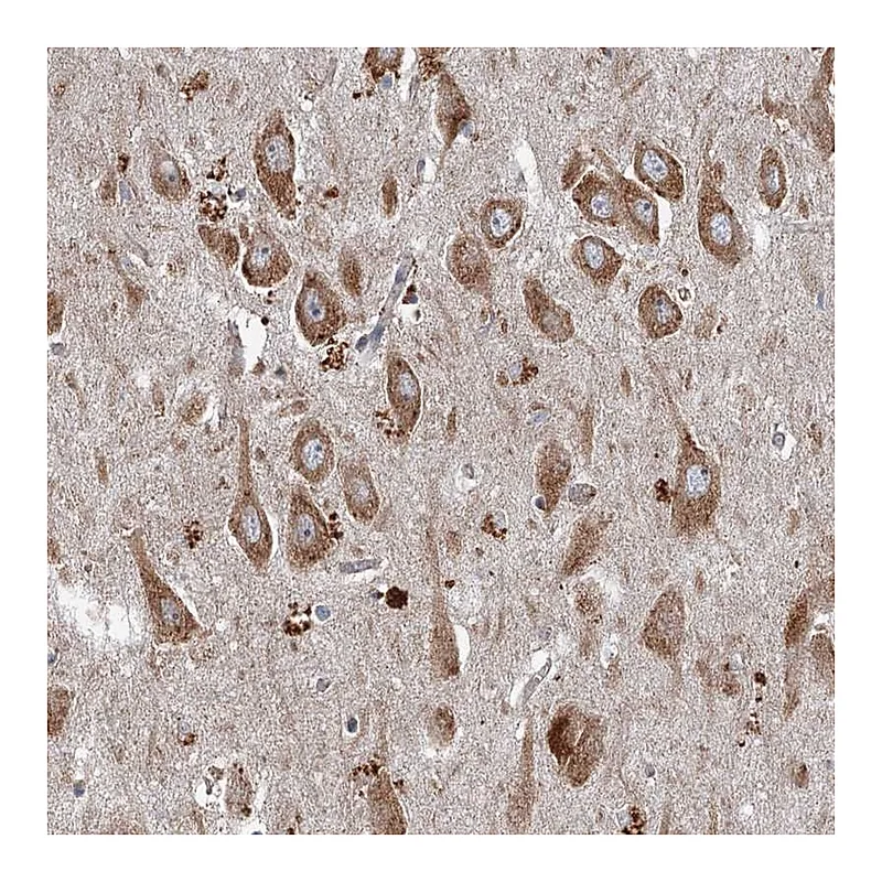 Atlas Antibodies Anti-SRPX2 Antibody