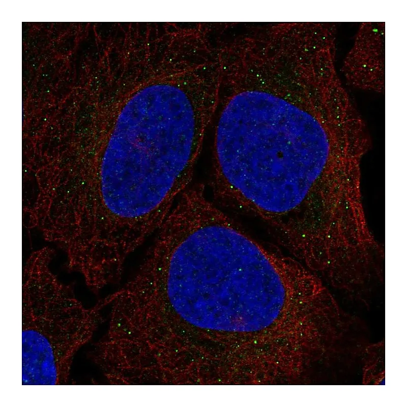 Atlas Antibodies Anti-SRR Antibody