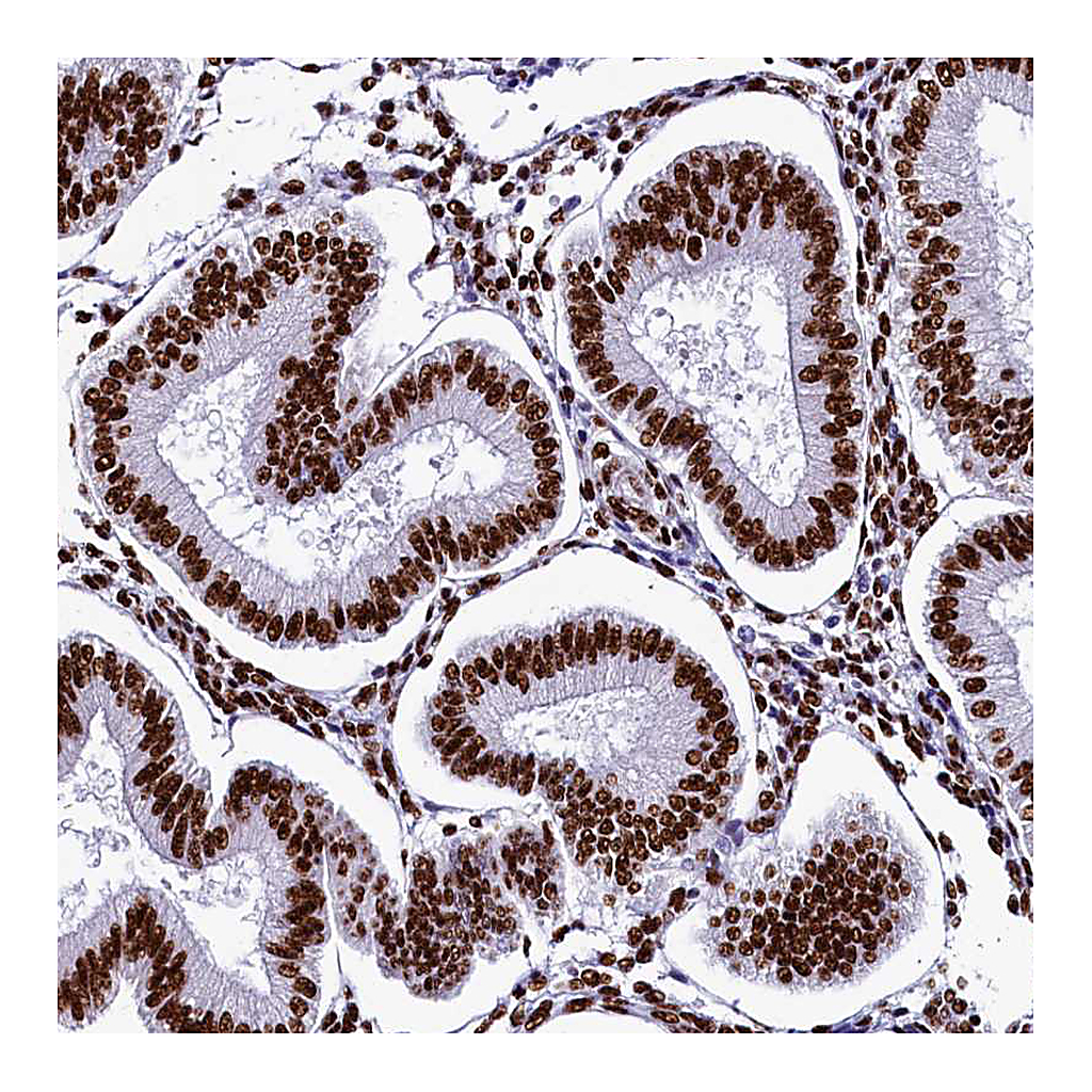 Atlas Antibodies Anti-SRRM2 Antibody