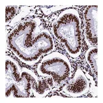 Atlas Antibodies Anti-SRRM2 Antibody