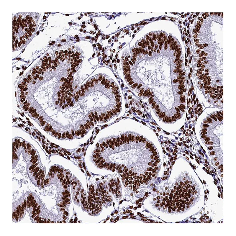 Atlas Antibodies Anti-SRRM2 Antibody