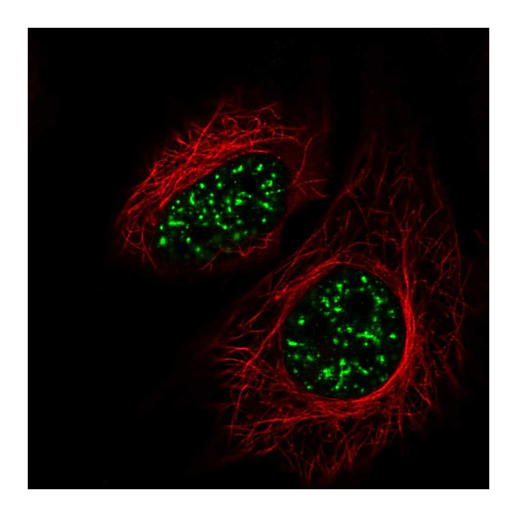 Atlas Antibodies Anti-SRRM2 Antibody