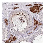Atlas Antibodies Anti-SRRM5 Antibody