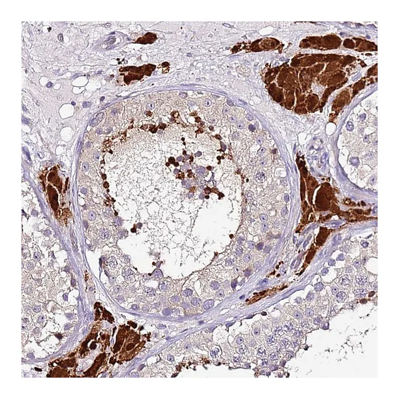 Atlas Antibodies Anti-SRRM5 Antibody