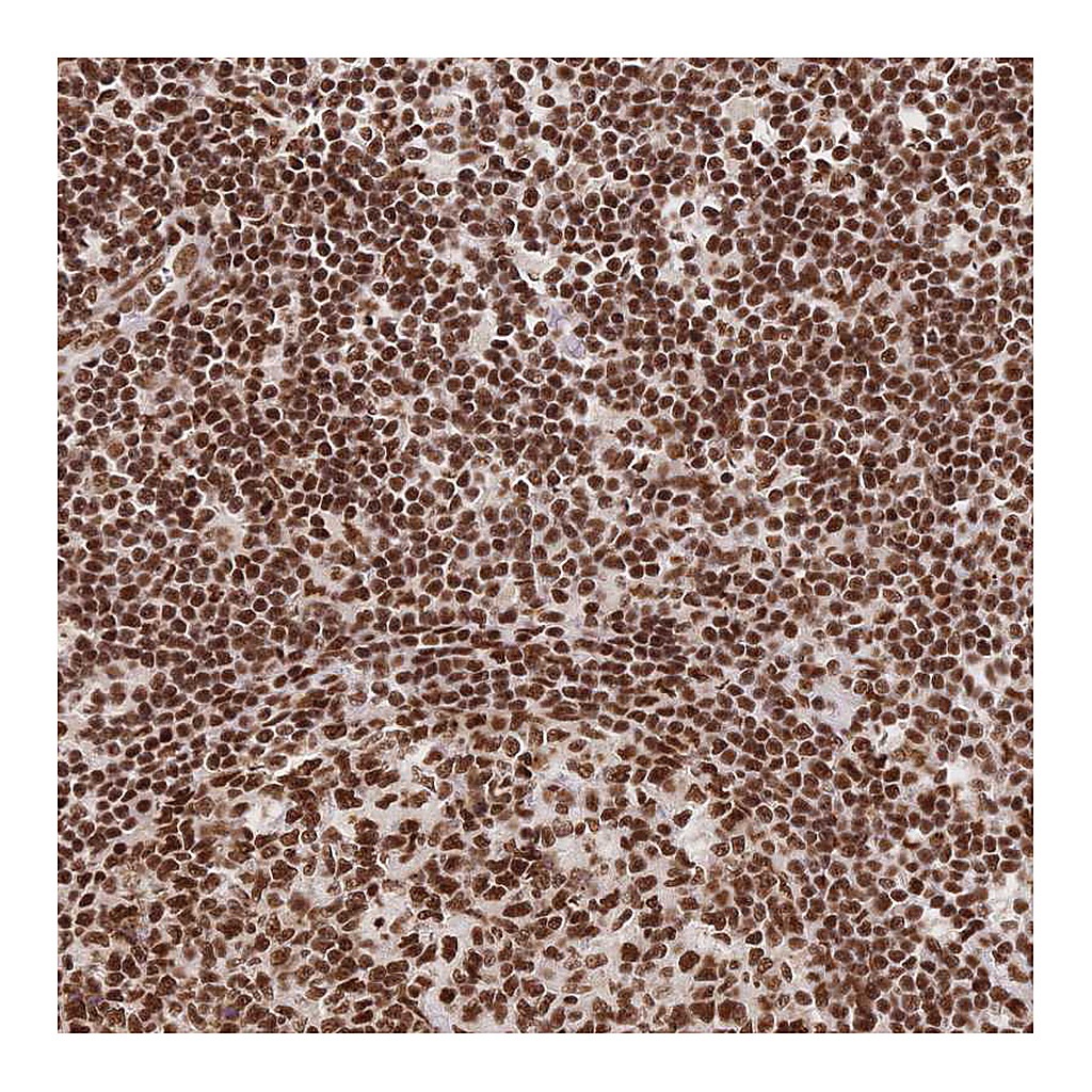 Atlas Antibodies Anti-SRSF1 Antibody