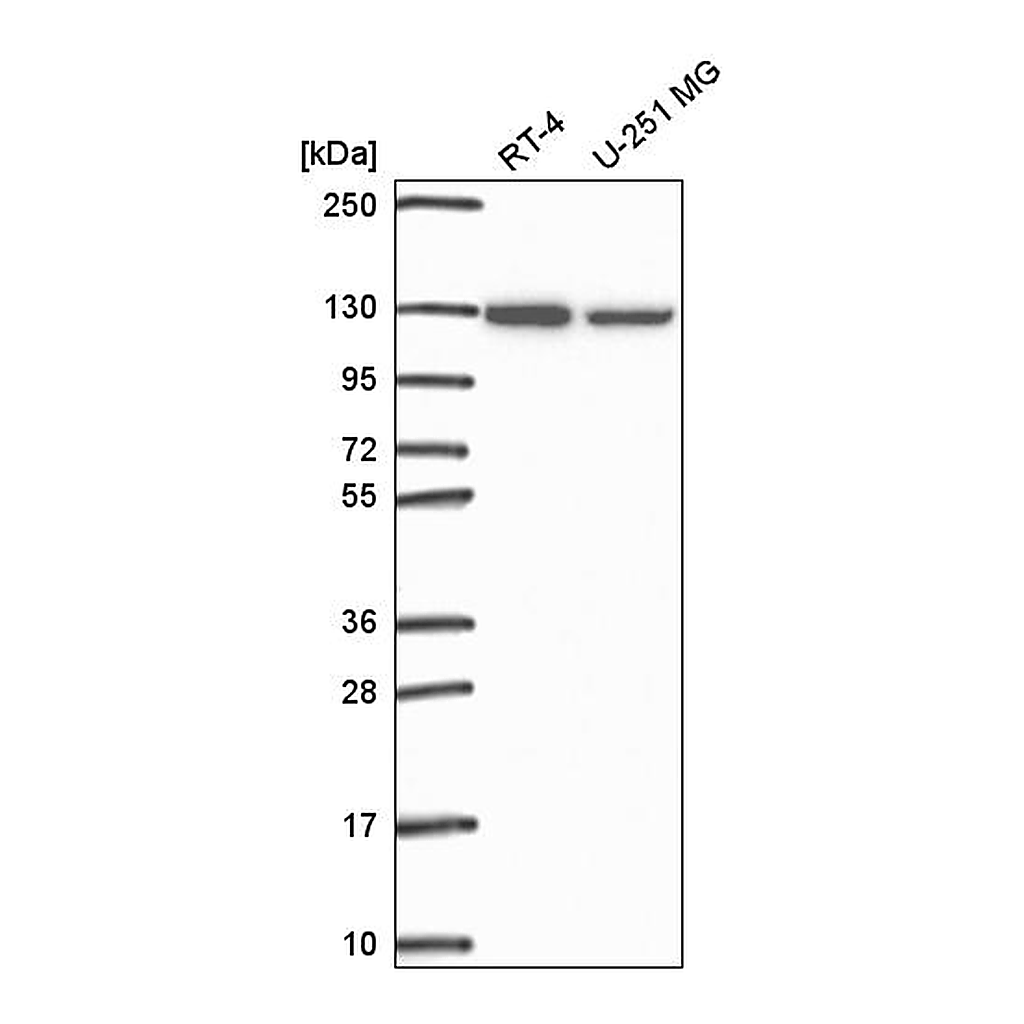 Atlas Antibodies Anti-SRRT Antibody