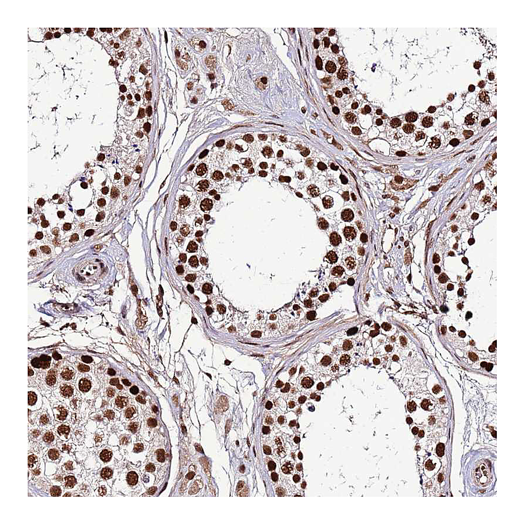 Atlas Antibodies Anti-SRRT Antibody
