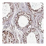Atlas Antibodies Anti-SRRT Antibody