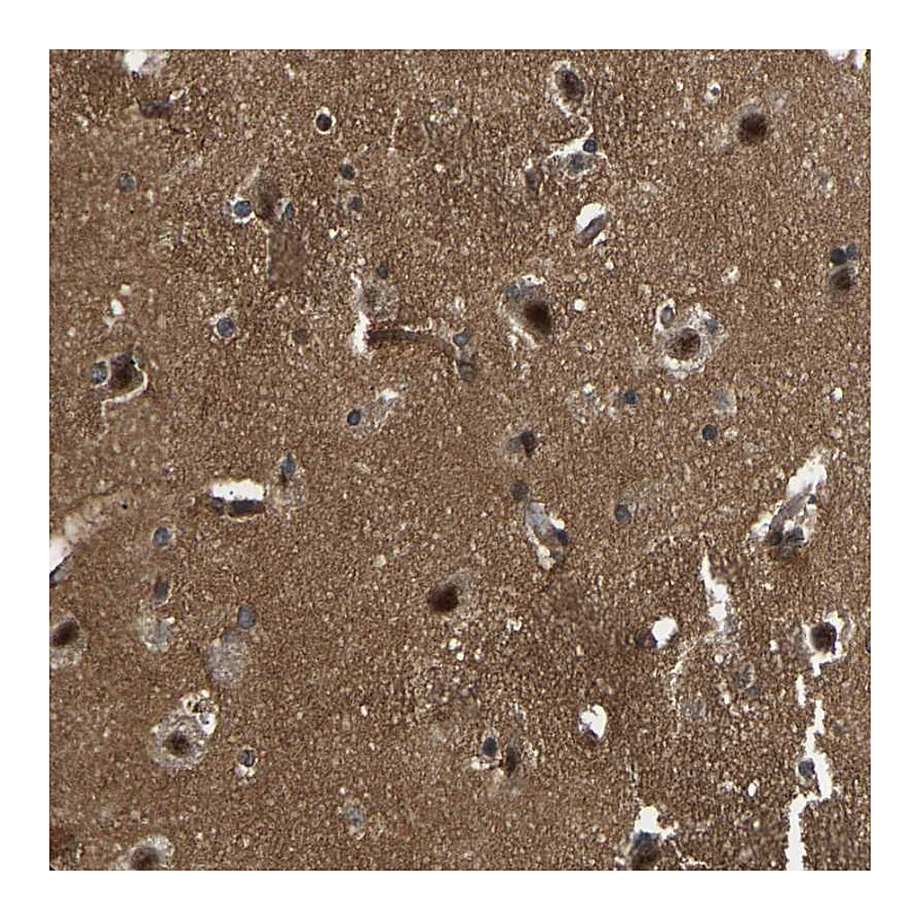 Atlas Antibodies Anti-SRRM3 Antibody