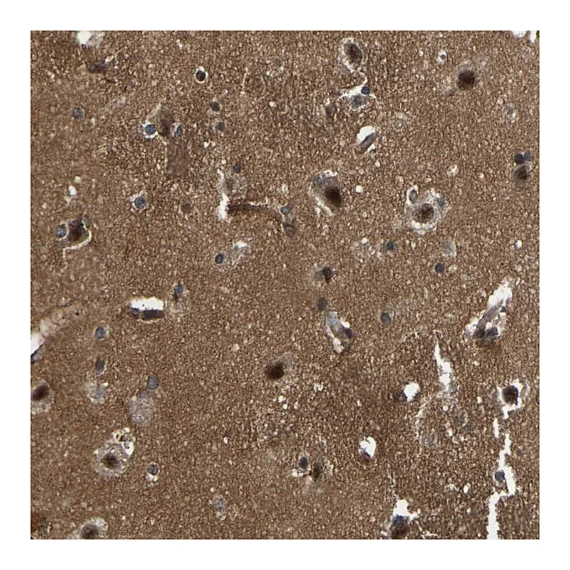 Atlas Antibodies Anti-SRRM3 Antibody