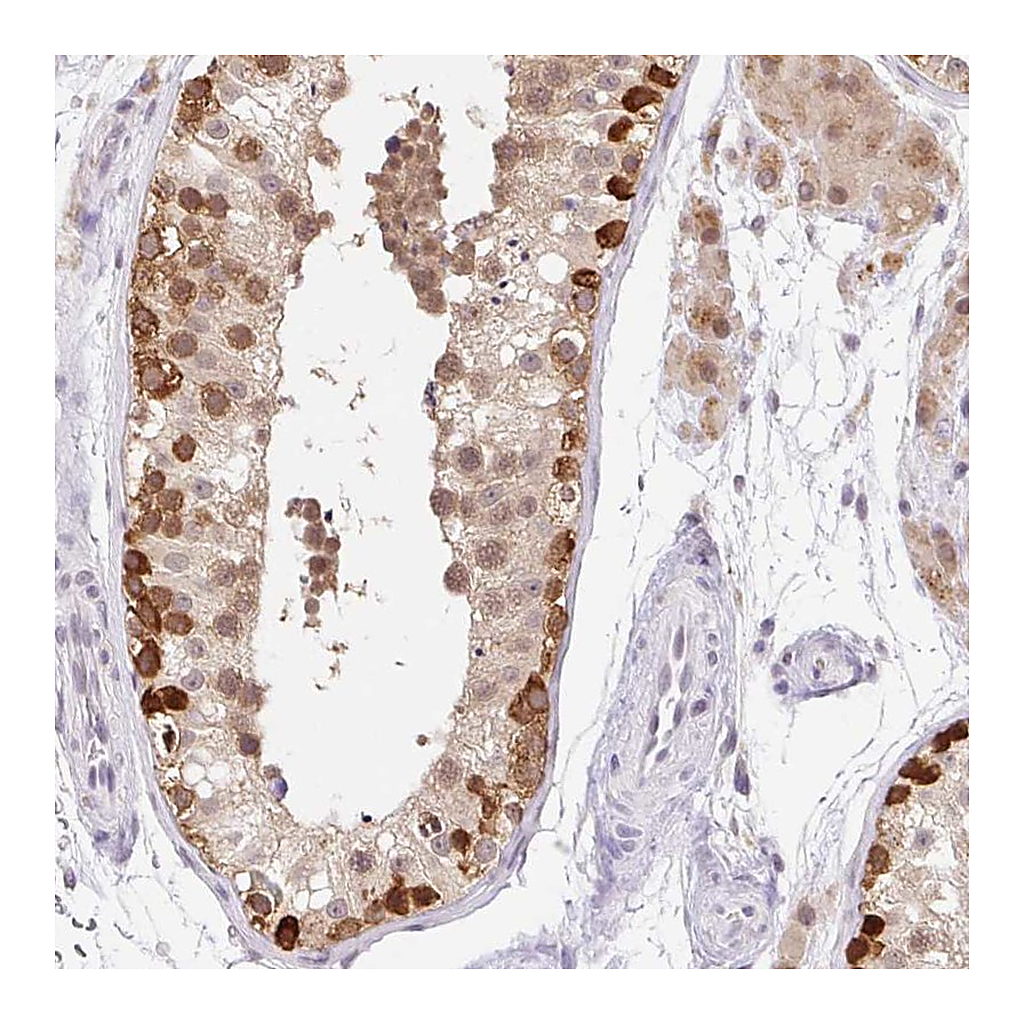 Atlas Antibodies Anti-SRSF10 Antibody