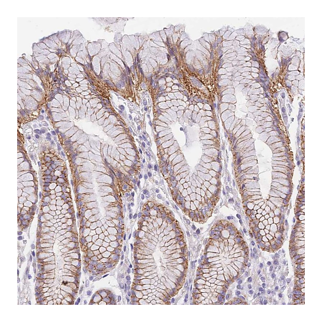 Atlas Antibodies Anti-SRSF12 Antibody