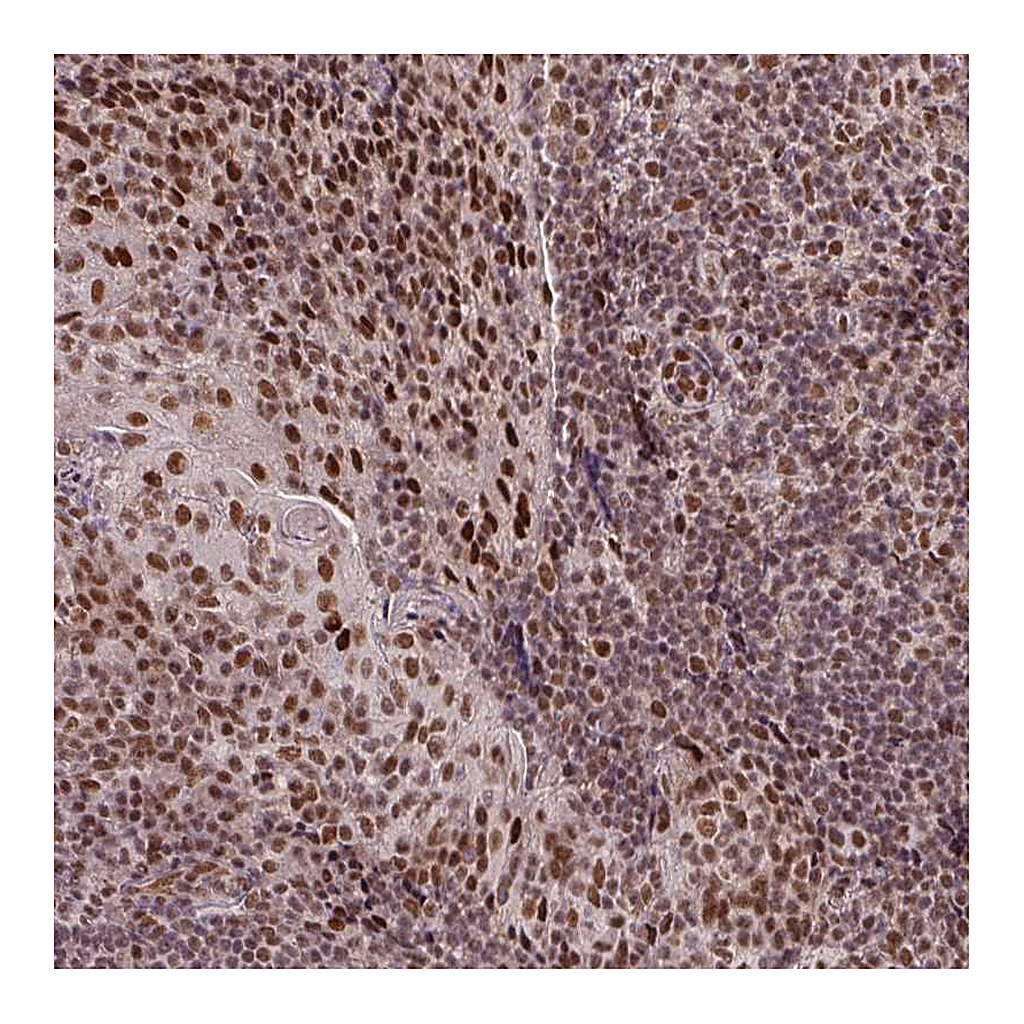 Atlas Antibodies Anti-SRSF2 Antibody