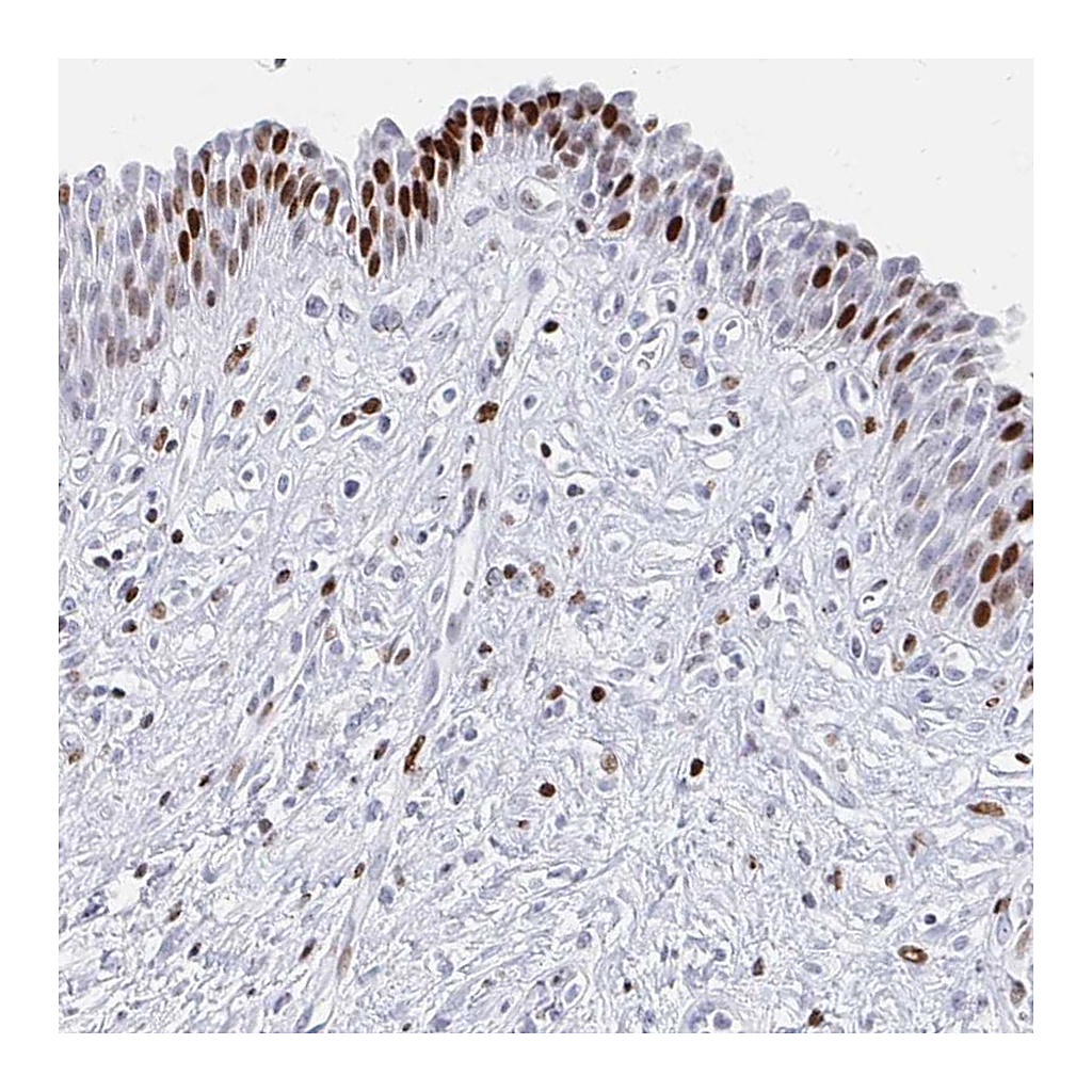 Atlas Antibodies Anti-SRSF3 Antibody