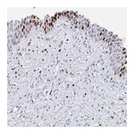 Atlas Antibodies Anti-SRSF3 Antibody