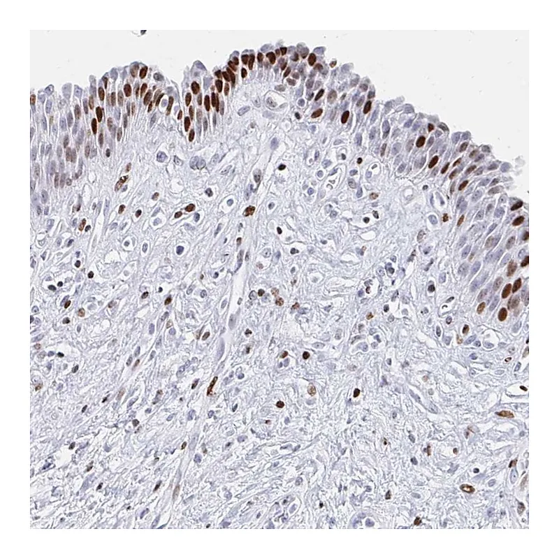 Atlas Antibodies Anti-SRSF3 Antibody