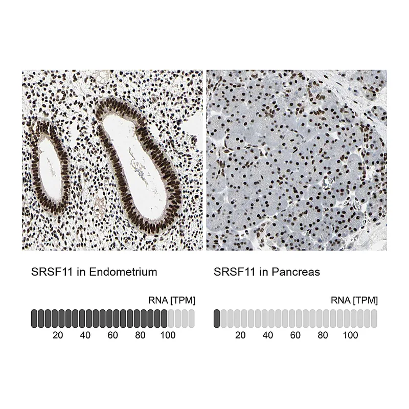 Atlas Antibodies Anti-SRSF11 Antibody